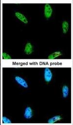 IPMK Polyclonal Antibody