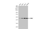 IPMK Antibody in Western Blot (WB)