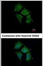 POMGNT1 Antibody in Immunocytochemistry (ICC/IF)