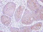 POMGNT1 Antibody in Immunohistochemistry (Paraffin) (IHC (P))