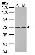 POMGNT1 Antibody in Western Blot (WB)