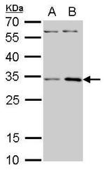 RPS3A Antibody in Western Blot (WB)