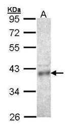 CPOX Polyclonal Antibody
