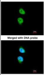 CAMK1D Antibody in Immunocytochemistry (ICC/IF)