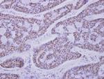 CAMK1D Antibody in Immunohistochemistry (Paraffin) (IHC (P))