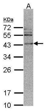 CAMK1D Antibody in Western Blot (WB)