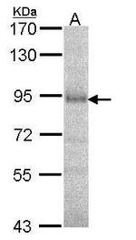 DPP8 Antibody in Western Blot (WB)