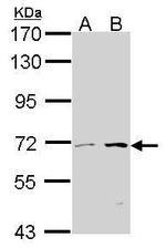 CROT Antibody in Western Blot (WB)