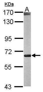 CROT Antibody in Western Blot (WB)