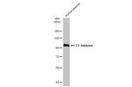 C1 inhibitor Antibody in Western Blot (WB)