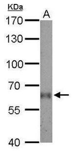 ETNPPL Isoform 1 Antibody in Western Blot (WB)