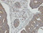 PPM1K Polyclonal Antibody