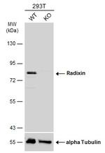 Radixin Antibody in Western Blot (WB)