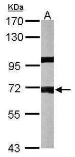 PPP1R16A Polyclonal Antibody