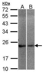 NCS1 Antibody in Western Blot (WB)