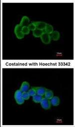 FLRT1 Polyclonal Antibody
