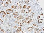 GSTA2 Antibody in Immunohistochemistry (Paraffin) (IHC (P))