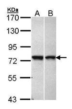 VPS51 Polyclonal Antibody
