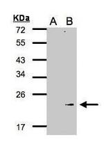 GPX7 Antibody in Western Blot (WB)