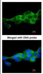 IKK beta Polyclonal Antibody
