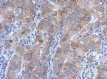 IKK beta Antibody in Immunohistochemistry (Paraffin) (IHC (P))
