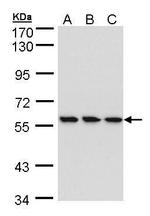 HCE Polyclonal Antibody