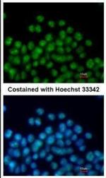 Nkx2.5 Antibody in Immunocytochemistry (ICC/IF)