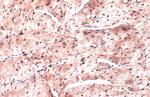 Nkx2.5 Antibody in Immunohistochemistry (Paraffin) (IHC (P))