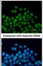 Nkx2.5 Antibody in Immunocytochemistry (ICC/IF)
