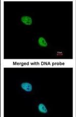 Nkx2.5 Antibody in Immunocytochemistry (ICC/IF)