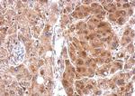 STAR Antibody in Immunohistochemistry (Paraffin) (IHC (P))