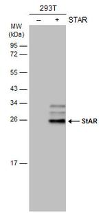 STAR Antibody in Western Blot (WB)