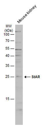 STAR Antibody in Western Blot (WB)