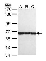 TCP-1 theta Antibody in Western Blot (WB)