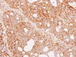 Renin Antibody in Immunohistochemistry (Paraffin) (IHC (P))