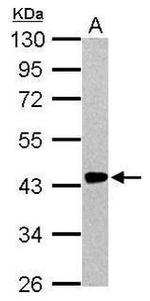 Renin Antibody in Western Blot (WB)