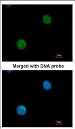 MYBPC2 Polyclonal Antibody