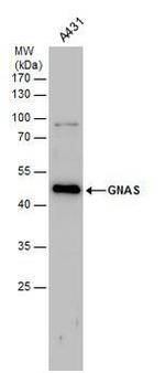 GNAS Antibody in Western Blot (WB)