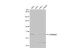 CYP24A1 Antibody in Western Blot (WB)