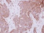STAM Polyclonal Antibody