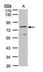 DPP3 Antibody in Western Blot (WB)
