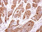 TBCC Polyclonal Antibody