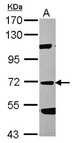 Factor XI Antibody in Western Blot (WB)