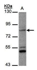PHEX Polyclonal Antibody
