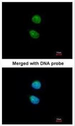 ZNF306 Polyclonal Antibody