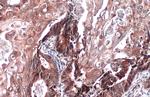ST3GAL1 Antibody in Immunohistochemistry (Paraffin) (IHC (P))