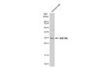 ST3GAL1 Antibody in Western Blot (WB)
