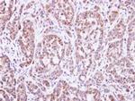 DGAT2 Antibody in Immunohistochemistry (Paraffin) (IHC (P))