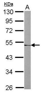 DGAT2 Antibody in Western Blot (WB)