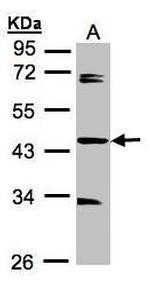 SDCCAG3 Isoform 1 Antibody in Western Blot (WB)